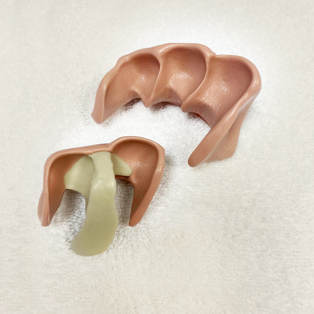 Hühneraugen entfernen Podologie Dresden